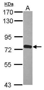 ZNF417 Polyclonal Antibody