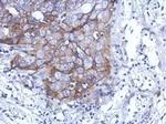 DDX59 Polyclonal Antibody