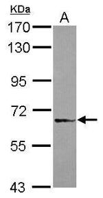 DDX59 Antibody in Western Blot (WB)