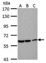 DDX59 Antibody in Western Blot (WB)