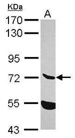 ENTPD7 Antibody in Western Blot (WB)