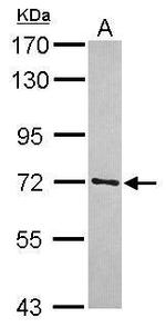 TRIM41 Antibody in Western Blot (WB)