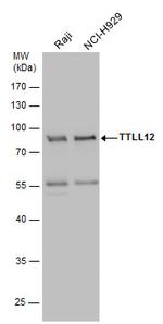 TTLL12 Antibody in Western Blot (WB)