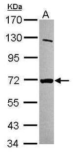 MTMR8 Polyclonal Antibody
