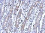 BEND2 Polyclonal Antibody