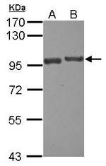 USP6NL Polyclonal Antibody