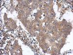 ANKLE2 Polyclonal Antibody
