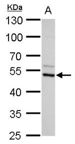 ADC Polyclonal Antibody