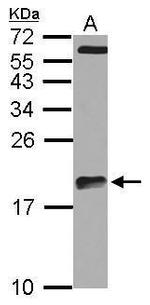ARPC5L Antibody in Western Blot (WB)