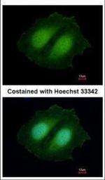 CBWD1 Polyclonal Antibody