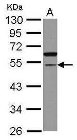 CDCA7L Antibody in Western Blot (WB)