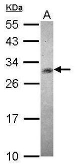 CHAC1 Polyclonal Antibody