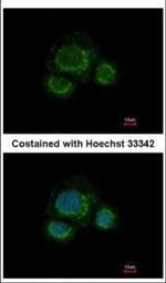 CHST7 Polyclonal Antibody