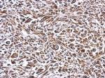 ERLIN1 Polyclonal Antibody