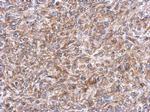 ERLIN1 Antibody in Immunohistochemistry (Paraffin) (IHC (P))