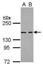 KDM6A Antibody in Western Blot (WB)