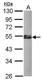 KLF17 Polyclonal Antibody