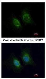 Cytokeratin 36 Antibody in Immunocytochemistry (ICC/IF)
