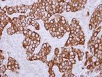 Cytokeratin 36 Antibody in Immunohistochemistry (Paraffin) (IHC (P))
