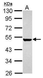 Cytokeratin 36 Antibody in Western Blot (WB)