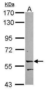 LRRC15 Antibody in Western Blot (WB)