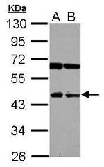 NEU4 Polyclonal Antibody