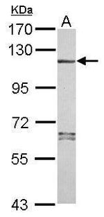 NALP7 Polyclonal Antibody