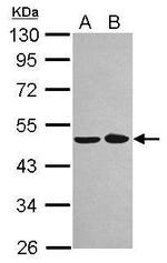 NOB1 Antibody in Western Blot (WB)