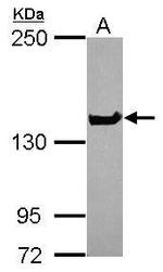 NUP155 Polyclonal Antibody