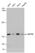 NUP155 Antibody in Western Blot (WB)