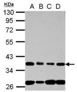 NUP35 Polyclonal Antibody