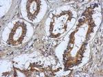 RASAL2 Polyclonal Antibody