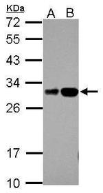 RILPL2 Antibody in Western Blot (WB)