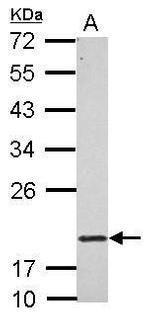 RNF5 Polyclonal Antibody
