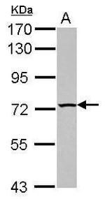 TBC1D15 Polyclonal Antibody