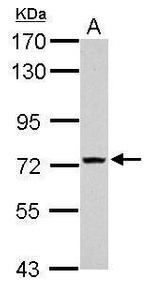 TMEM62 Polyclonal Antibody