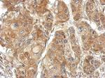 TSR2 Polyclonal Antibody