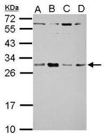 TSR2 Antibody in Western Blot (WB)