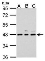 UPP2 Polyclonal Antibody