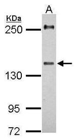 URB2 Polyclonal Antibody