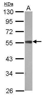 ZC3H10 Polyclonal Antibody