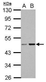 CC2D2B Antibody in Western Blot (WB)