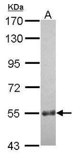 CCDC7 Polyclonal Antibody