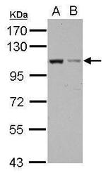 EXOC2 Polyclonal Antibody