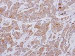 GEFT Polyclonal Antibody