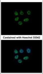 KDM6A Antibody in Immunocytochemistry (ICC/IF)
