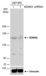 KDM6A Antibody in Western Blot (WB)