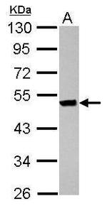 Cytokeratin 36 Antibody in Western Blot (WB)