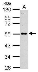 MAGEB18 Antibody in Western Blot (WB)