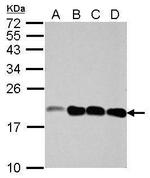 NCALD Antibody in Western Blot (WB)